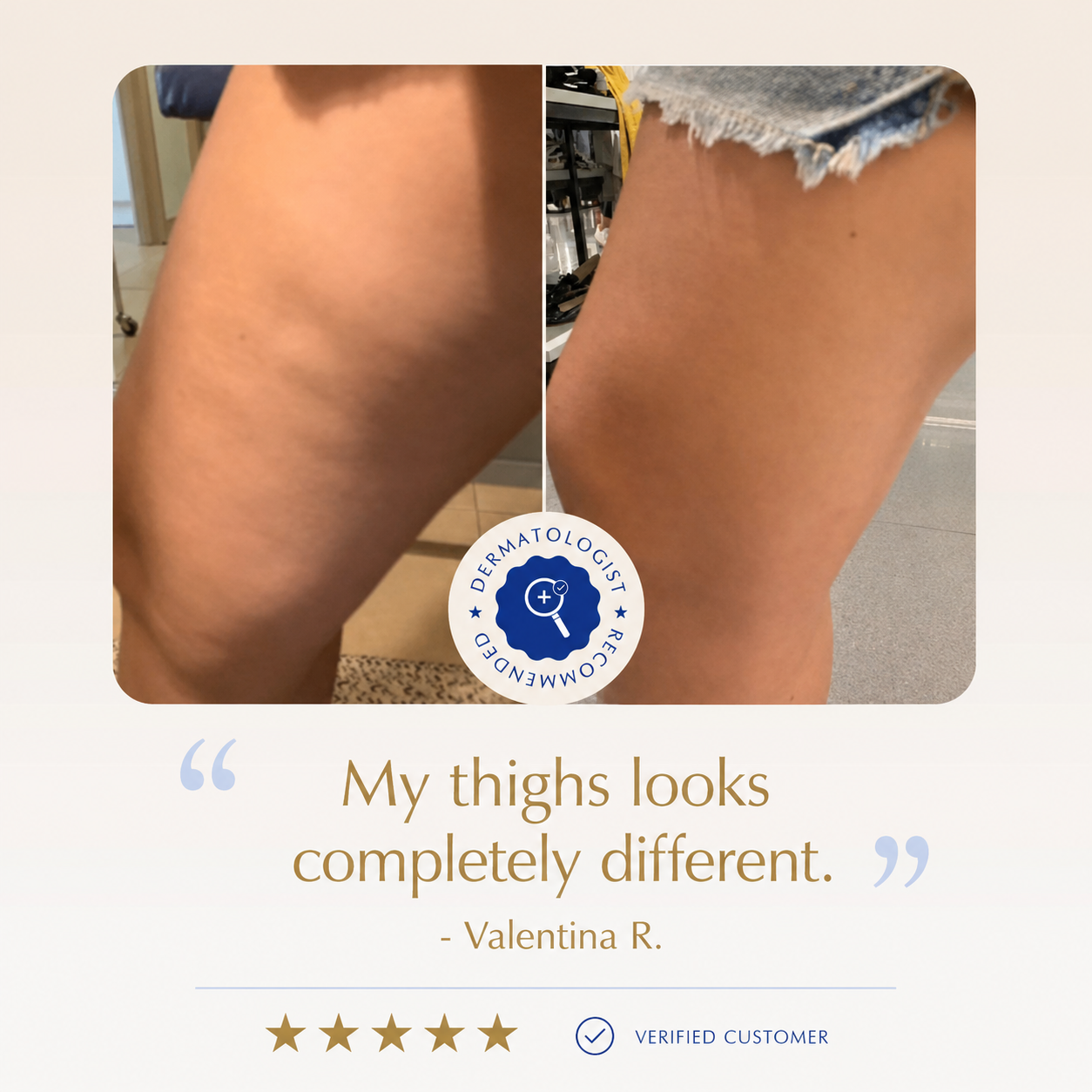 15-Day Firming Gel — Visibly Smoother Legs & Body