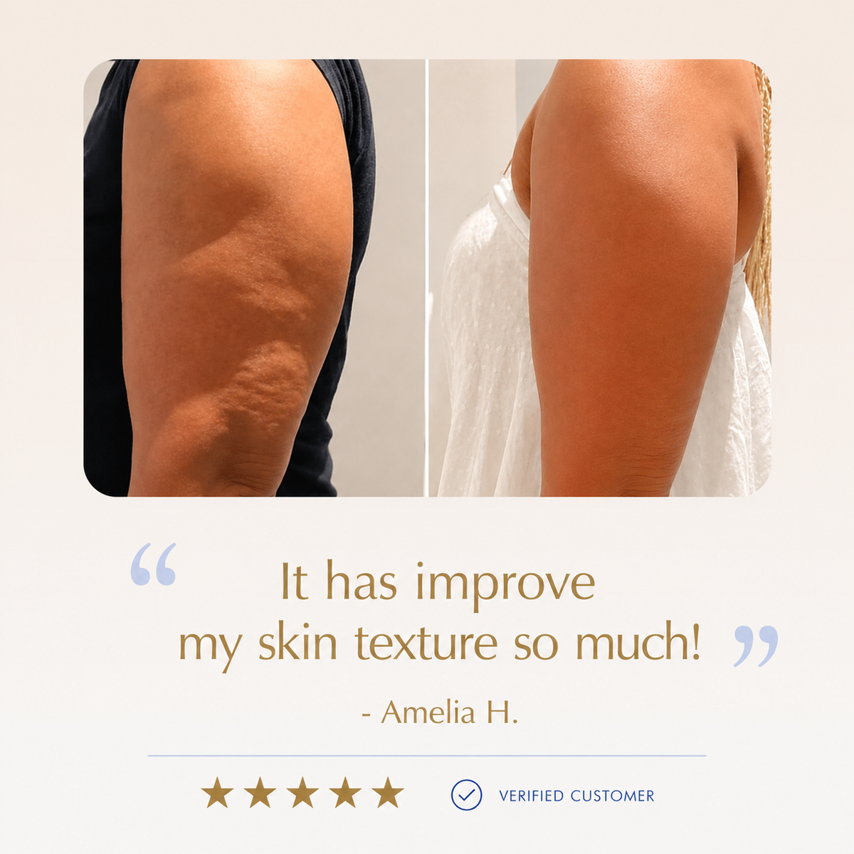 15-Day Firming Gel — Visibly Smoother Legs & Body